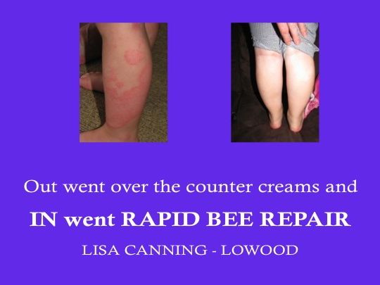 Out went over the counter creams and in went Rapid BEERepair